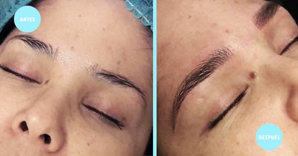 Microblading Pelo a Pelo en Guadalajara Antes y Despues